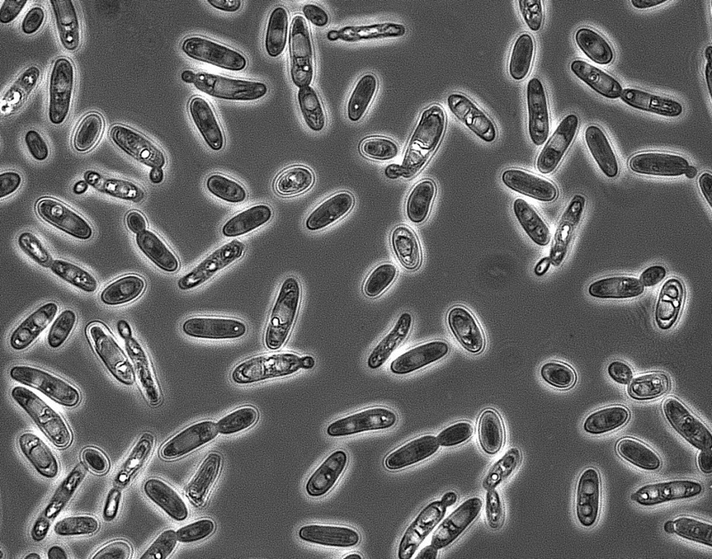 Brettanomyces