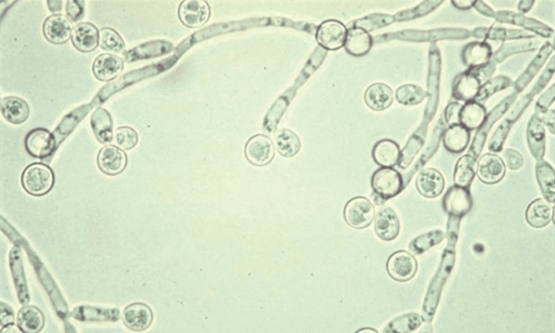 Candida milleri